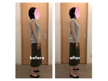 みらい整骨院/反り腰を根本改善