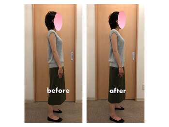 みらい整骨院/反り腰を根本改善