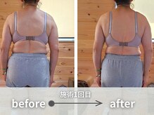 カラダの水脈ケアで直後からスッキリ☆【痩身・むくみに】