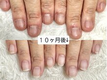 グレースレディ 大阪店/深爪/自爪育成/フィルイン