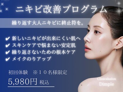 ディンプル(Dimple)の写真