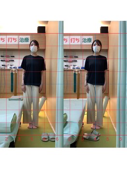 よし鍼灸接骨院 南堀江院/骨盤矯正/マッサージ整体/鍼灸