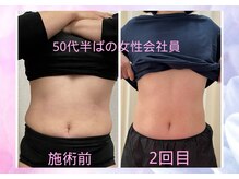 ハナノ整体院/お腹周りスッキリなりました