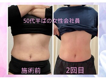 ハナノ整体院/お腹周りスッキリなりました