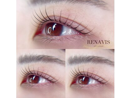 レナヴィス(RENAVIS)の写真