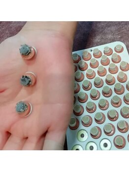 高麗鍼灸院/87手にあるツボにお灸