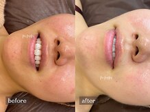 ムーマイニー(m maini)/赤みを抑え、トーンアップも◎