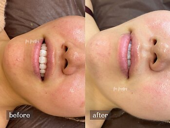 ムーマイニー(m maini)/赤みを抑え、トーンアップも◎