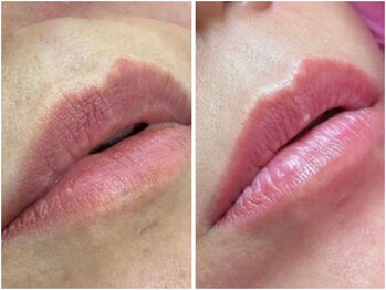 ピンクアンドプラウドサロン 横浜(Pink& Proud Salon)/ローマピンク【唇】