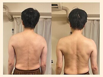 ラフリー 四条烏丸院(RUFFREE)/身体の歪みを根本改善【四条】