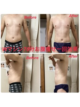 ミュー 新小岩店(Mieux)/Wマシン70分一回効果