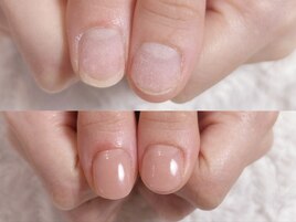 深爪　育爪の為のオイル