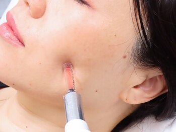 スカルプメンテ 広尾 恵比寿(SCALPMENTE)の写真/【極上白玉×水光肌】透明感＆潤いが同時に叶う美肌施術！くすみ＆たるみ改善でトーンUPの若々しい見た目へ