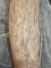 エリクサー 熊谷店(Elixir)/足脱毛してると女性ウケUP！