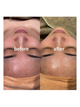 ラシンバン(Lashinvan)/コルギ