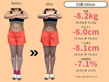 ニドム/37歳　-8kg産後痩身ダイエット1