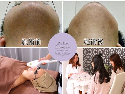 ベルエポック 八事(Belle Epoque)の写真