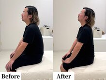 ソレア(Solea)/姿勢改善1回目 Before/After