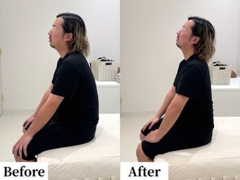 ソレア(Solea)/姿勢改善1回目 Before/After