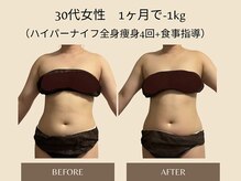 オベリオ(OBERIO)/ハイパーナイフ全身痩身