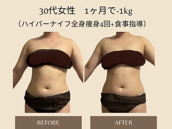オベリオ(OBERIO)/ハイパーナイフ全身痩身