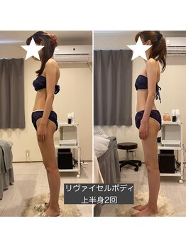 グラニット(Granit.)/ボディBeforeAfter