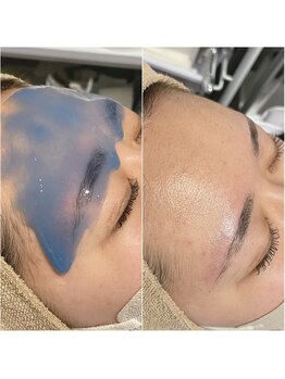 リブ(Lib)/アイブロウ後のパックにも◎