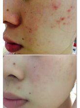 モンクラッシー(Mon classy)/