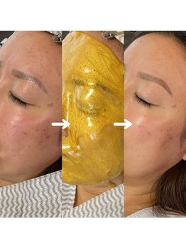 フー 広島(Fuu)/*