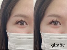 ジラフ(giraffe)/【ラッシュリフト】立ち上げ