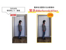 にこにこ整体 整骨院/【腰痛・猫背矯正】整体をBE⇒AF