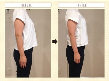 ルクラ(Lucura)/姿勢改善