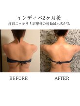 ワン ストレッチ(ONE stretch)/【背中美人】