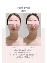 トゥインクル 麻布(twinkle)/港区南麻布シンメトリー小顔矯正