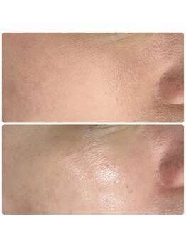 ラウレア(Laule'a)/津山|ツヤ肌フェイシャル