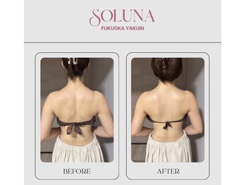 ソルナ 福岡薬院店(SOLUNA)/【1回での変化】