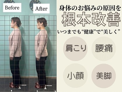 ハチ(HACHI)の写真