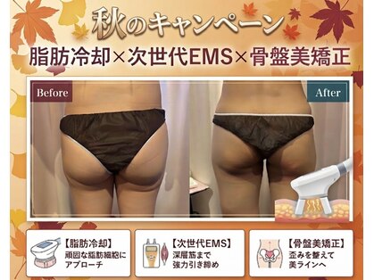 モテスリムの写真