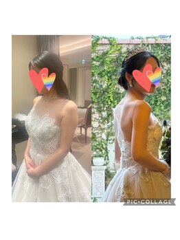 ハートエルボー(Heart elbow)/ブライダルのお客様