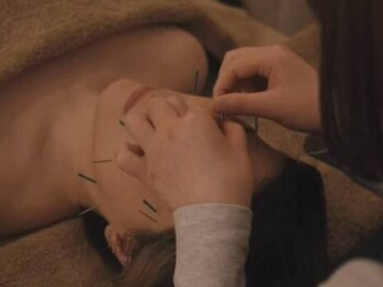 クク 赤坂 天神(99 KUKU)の写真/「何となく」以上の結果がほしい方へ◎小顔も美肌も美容鍼で◎キーワードは”表情筋”と”血行促進”