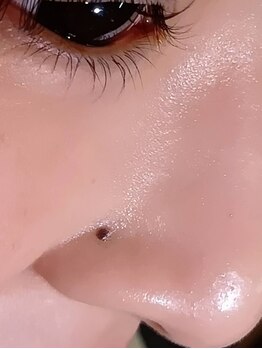 毛穴ケアをしたい