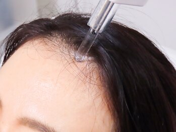 スカルプメンテ 広尾 恵比寿(SCALPMENTE)の写真/気になる分け目・生え際・目立つ頭皮にアプローチ！将来の髪の健康を守る、最新美容に基づくエイジングケア