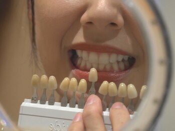 ホノルルホワイトニング 京橋店の写真/【第一印象は白い歯で差をつける】清潔感のある口元は印象づくりに大切☆営業マンの方ホワイトニング好評◎