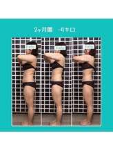 エスティービューティーサロン 南越谷店/【パーツモニター様】