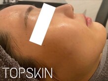 トップスキン 名駅(TOPSKIN)/美容成分をたっぷり高濃度配合♪