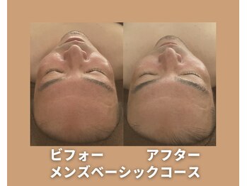 アオイスター(AOIstar)/メンズフェイシャル