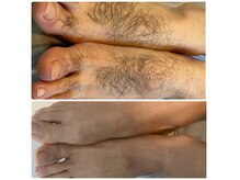 まほうのての雰囲気(メンズ脱毛)