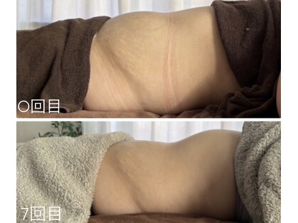 ポエマ(POEMA)の写真