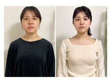 蒼(so)/全身バランス矯正・小顔矯正