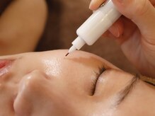 タイム(THYME)の雰囲気（多種のシミケア機器で色々な種類のシミを改善◎目周りにも◎）